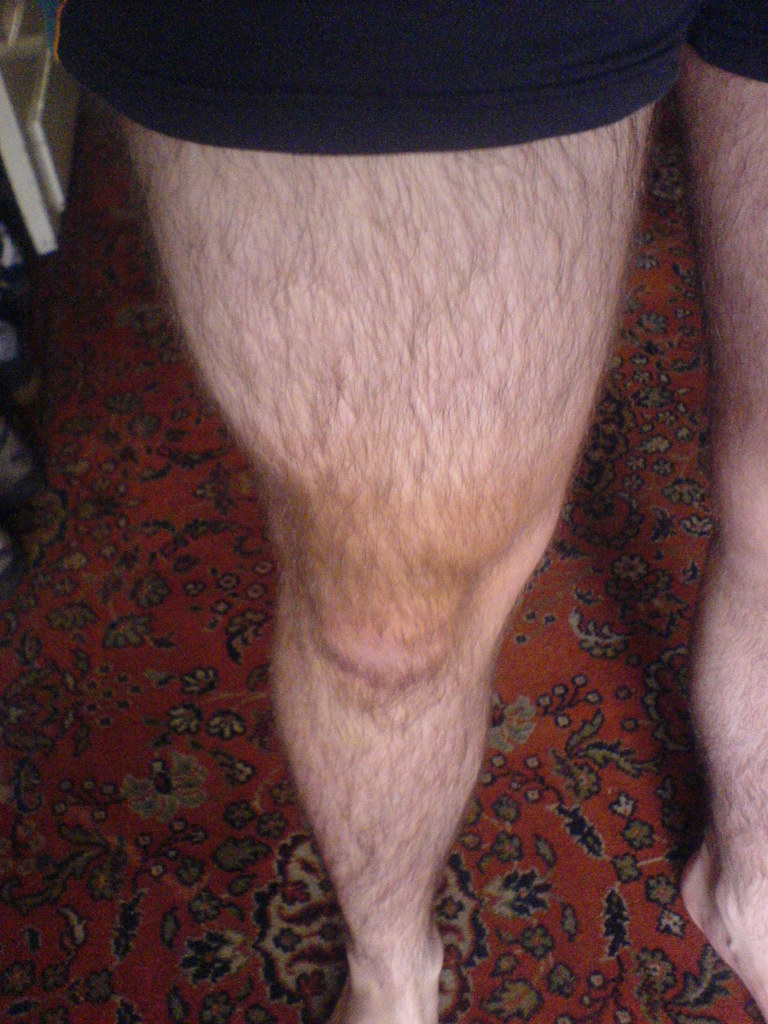 Beinhaare männer Beine rasieren: